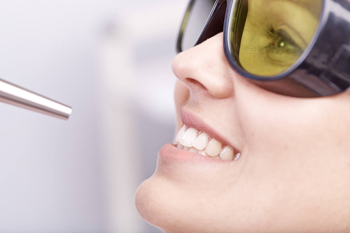 Zahn-laser-behandlung